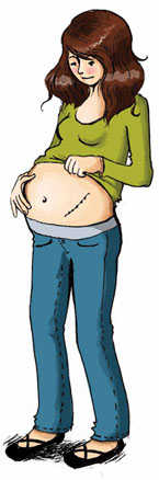 grossesse et transplantation rénale