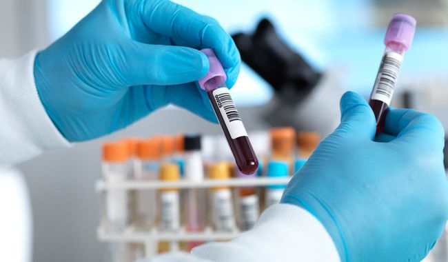  Alerte : allongement des délais pour les dosages de tacrolimus par les laboratoires Biomnis