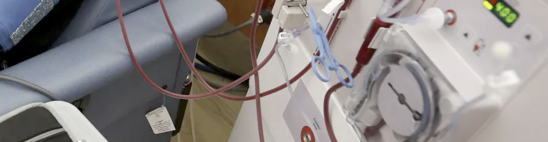  Renaloo demande la mise en œuvre d’un plan d’action d’urgence pour sauver les patients dialysés en Nouvelle Calédonie