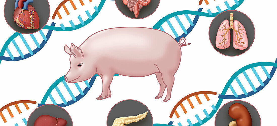  📢  Xénogreffe : deux mois après avoir reçu le rein d’un porc, Towana va bien !