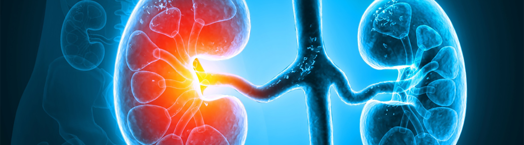  🌍 Le Lancet sonne l’alarme : la crise mondiale de la maladie rénale chronique ne doit plus être négligée !